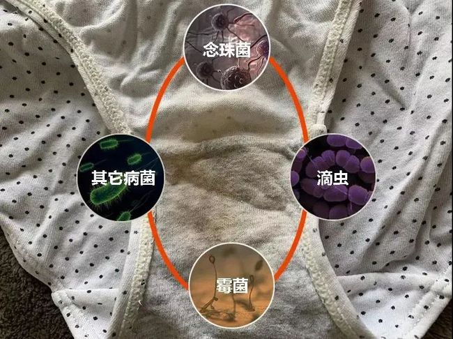 阴部瘙痒异味_阴部瘙痒小便异味尿不尽_阴部异味太大