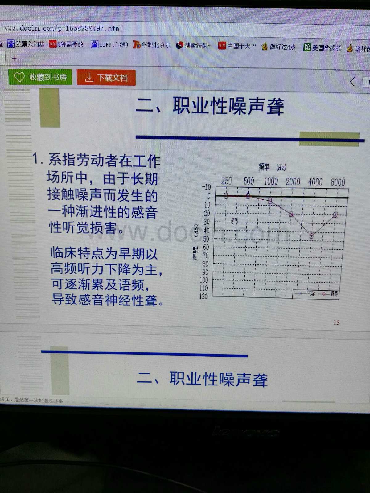 玩游戏你耳朵聋吗_手机游戏会导致耳聋吗_玩游戏会耳鸣吗