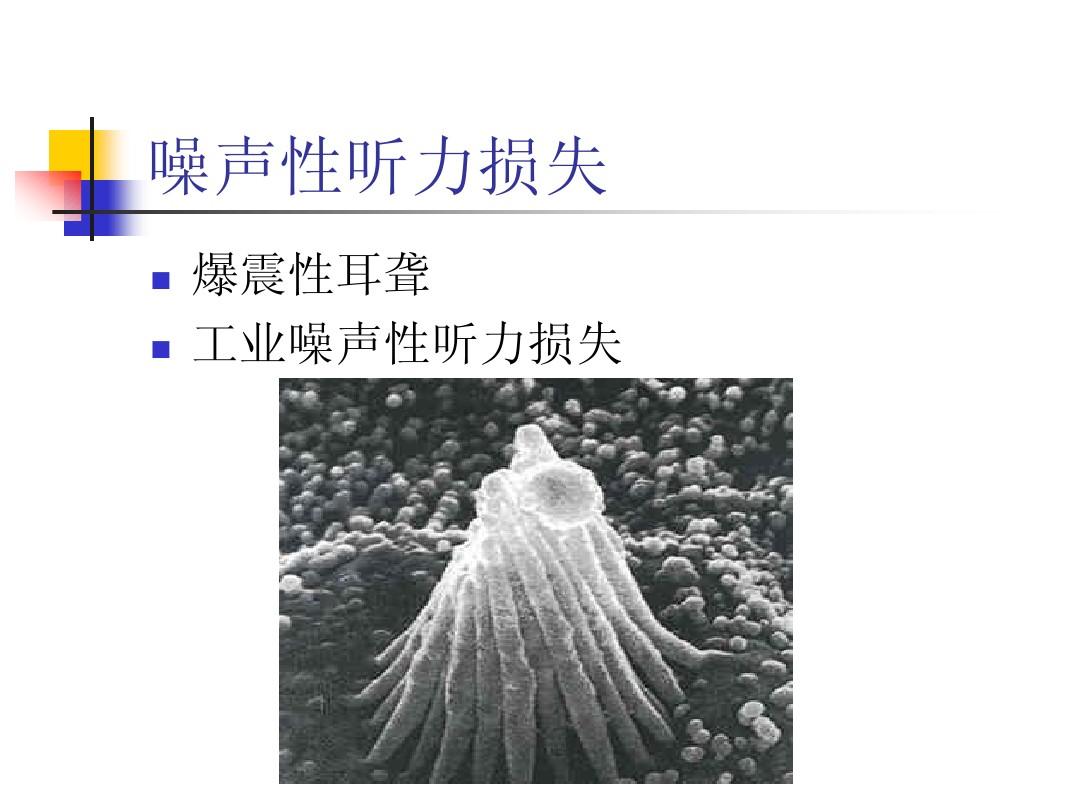 玩游戏会耳鸣吗_玩游戏你耳朵聋吗_手机游戏会导致耳聋吗